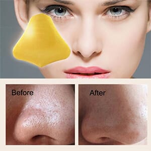 Gold Collagen Nose Mask 4 - Pack - $10.00 with FREE Shipping!